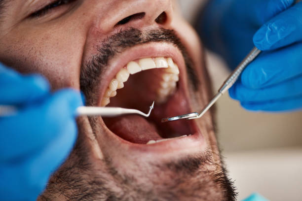 Laser Dentistry in Glens Falls, NY